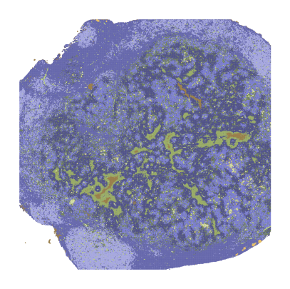 _images/tutorial_tumor_15_0.png